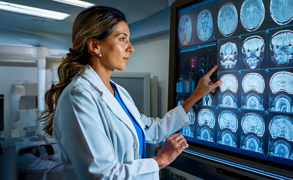 doctora revisando scaner cerebral
